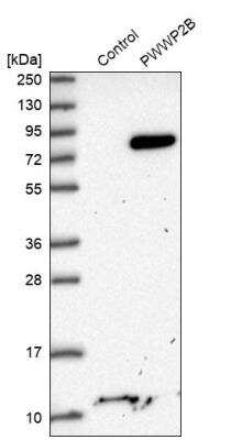 Western Blot: PWWP2B Antibody [NBP1-88764]