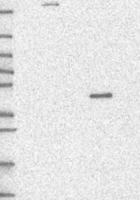 Western Blot: PWWP2B Antibody [NBP3-17422]