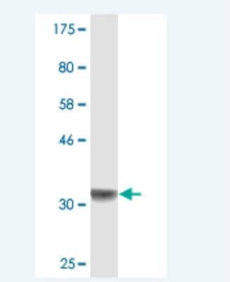 Western Blot: PX19 Antibody (6G1) [H00027166-M02]