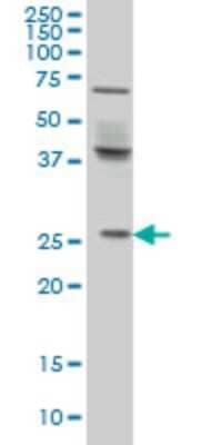 Western Blot: PX19 Antibody (7B4) [H00027166-M01]