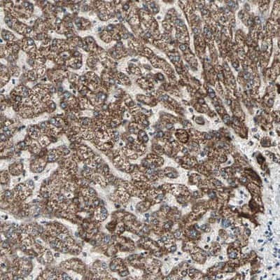 Immunohistochemistry-Paraffin: PX19 Antibody [NBP1-88093]
