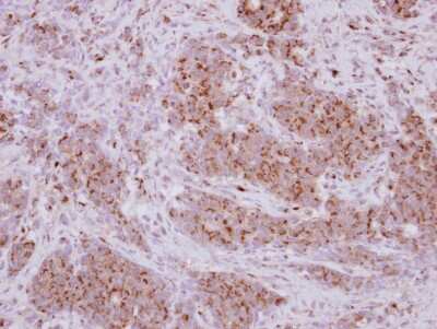 Immunohistochemistry-Paraffin: PX19 Antibody [NBP2-20015]