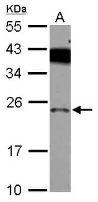 Western Blot: PX19 Antibody [NBP2-20015]