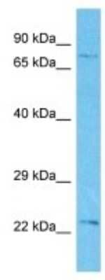 Western Blot: PX19 Antibody [NBP3-10160]