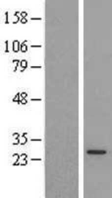 Western Blot: PX19 Overexpression Lysate [NBL1-14745]