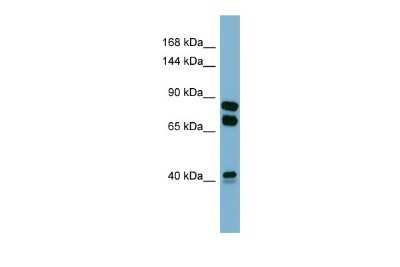 Western Blot: PXDN Antibody [NBP2-84231]