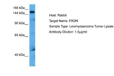 Western Blot: PXDN Antibody [NBP2-84232]