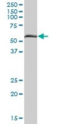 Western Blot: PXK Antibody [H00054899-B01P]