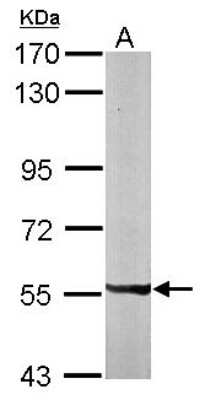 Western Blot: PXK Antibody [NBP1-33230]