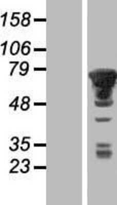 Western Blot: PXK Overexpression Lysate [NBP2-06918]