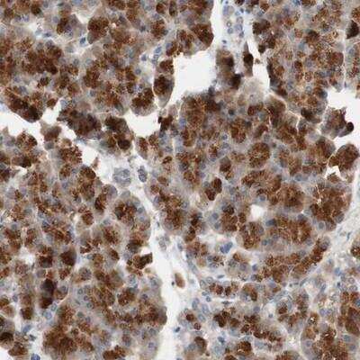 Immunohistochemistry: PXMP3 Antibody [NBP1-87352]