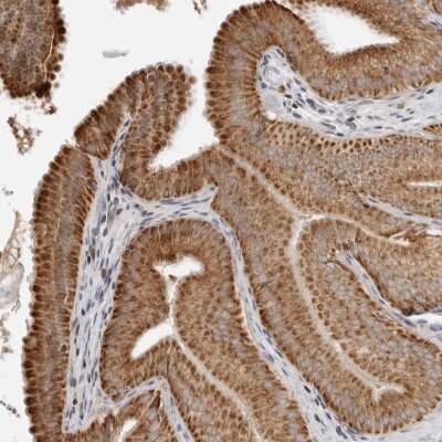 Immunohistochemistry-Paraffin: PXMP3 Antibody [NBP1-87351]