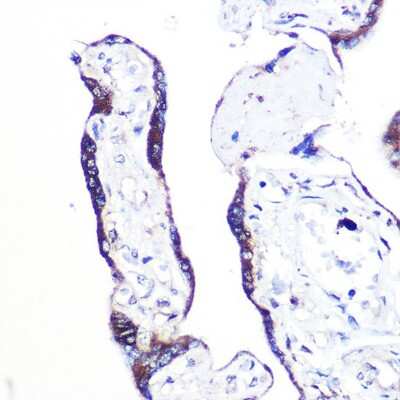 Immunohistochemistry-Paraffin: PXMP3 Antibody - Azide and BSA Free [NBP2-94643]