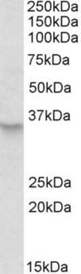 Western Blot: PXMP3 Antibody [NBP1-49876]