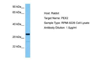 Western Blot: PXMP3 Antibody [NBP2-88106]