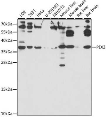 Western Blot: PXMP3 AntibodyAzide and BSA Free [NBP2-94643]