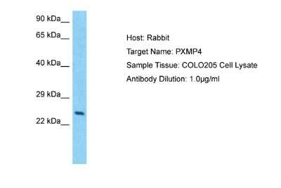 Western Blot: PXMP4 Antibody [NBP2-85561]