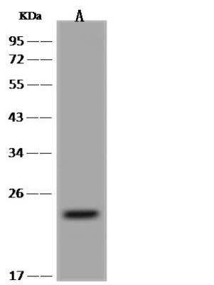 Western Blot: PXMP4 Antibody [NBP3-05927]