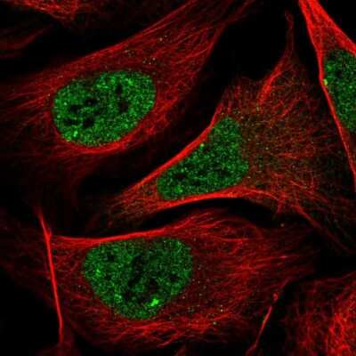 Immunocytochemistry/ Immunofluorescence: PXR/NR1I2 Antibody [NBP2-55441]