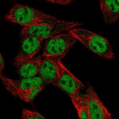 Immunocytochemistry/ Immunofluorescence: PXR/NR1I2 Antibody [NBP2-56568]