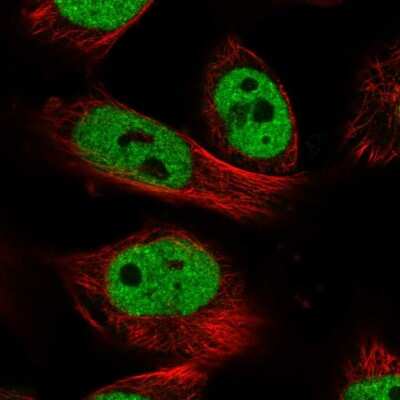 Immunocytochemistry/ Immunofluorescence: PXR/NR1I2 Antibody [NBP2-58514]