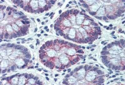 Immunohistochemistry-Paraffin: PXR/NR1I2 Antibody [NBP1-28799]