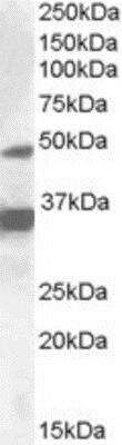 Western Blot: PXR/NR1I2 Antibody [NBP1-28799]