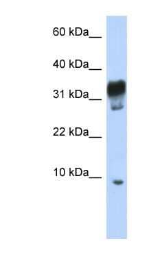 Western Blot: PXT1 Antibody [NBP1-70693]