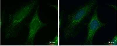 Immunocytochemistry/ Immunofluorescence: PYCR1 Antibody [NBP2-20016]