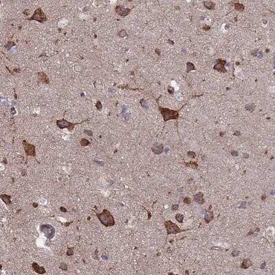 Immunohistochemistry-Paraffin: PYCR1 Antibody [NBP2-13834]