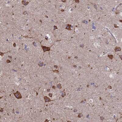 Immunohistochemistry-Paraffin: PYCR1 Antibody [NBP2-13834]