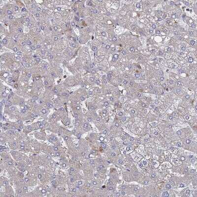 Immunohistochemistry-Paraffin: PYCR1 Antibody [NBP2-13834]