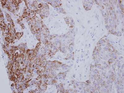 Immunohistochemistry-Paraffin: PYCR1 Antibody [NBP2-20016]