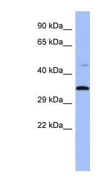 Western Blot: PYCR1 Antibody [NBP1-57934]