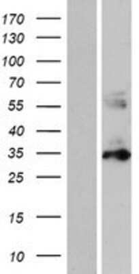 Western Blot: PYCR1 Overexpression Lysate [NBP2-05230]