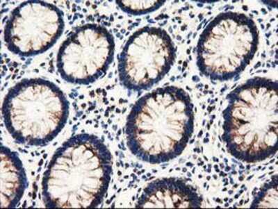 Immunohistochemistry-Paraffin: PYCR2 Antibody (OTI3D1) [NBP2-03187]