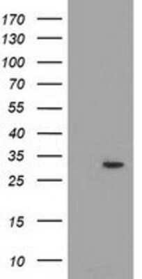 Western Blot: PYCR2 Antibody (OTI3D1) [NBP2-03187]