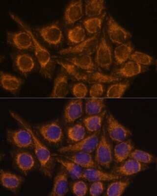 Immunocytochemistry/ Immunofluorescence: PYCR2 Antibody - Azide and BSA Free [NBP2-93882]