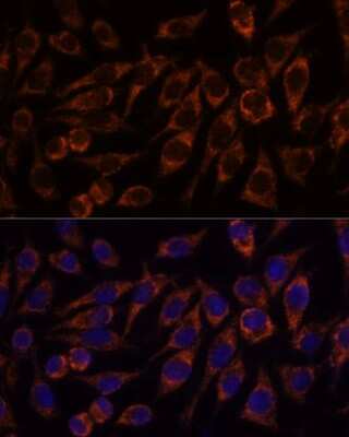 Immunocytochemistry/ Immunofluorescence: PYCR2 Antibody - Azide and BSA Free [NBP2-93882]