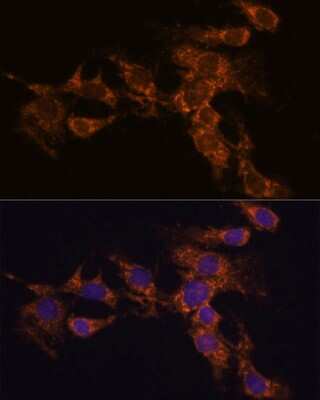 Immunocytochemistry/ Immunofluorescence: PYCR2 Antibody - Azide and BSA Free [NBP2-93882]