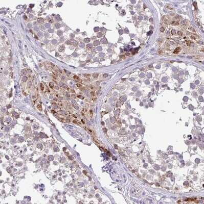 Immunohistochemistry-Paraffin: PYCR2 Antibody [NBP2-47318]