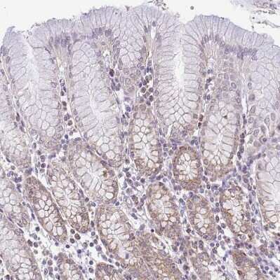 Immunohistochemistry-Paraffin: PYCR2 Antibody [NBP2-47318]