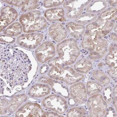 Immunohistochemistry-Paraffin: PYCR2 Antibody [NBP2-47318]