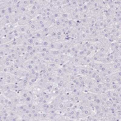Immunohistochemistry-Paraffin: PYCR2 Antibody [NBP2-47318]