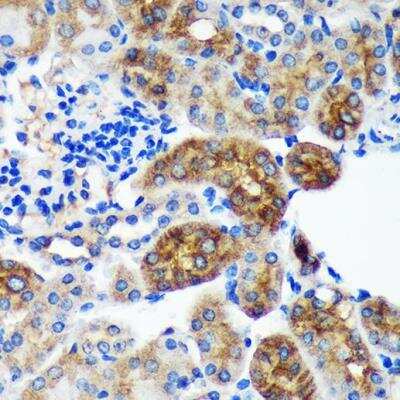 Immunohistochemistry-Paraffin: PYCR2 Antibody - Azide and BSA Free [NBP2-93882]