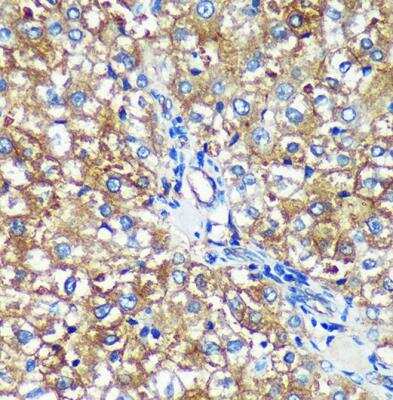 Immunohistochemistry-Paraffin: PYCR2 Antibody - Azide and BSA Free [NBP2-93882]