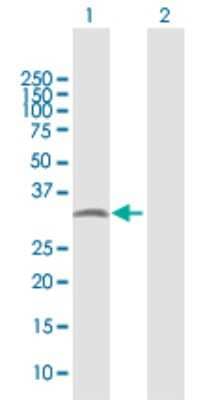 Western Blot: PYCR2 Antibody [H00029920-D01P]