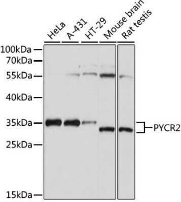 Western Blot: PYCR2 AntibodyAzide and BSA Free [NBP2-93882]