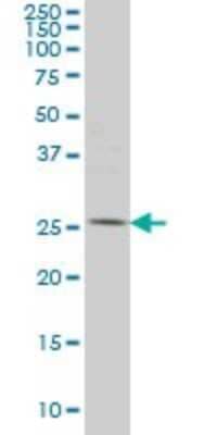 Western Blot: PYCRL Antibody (4F11) [H00065263-M01]