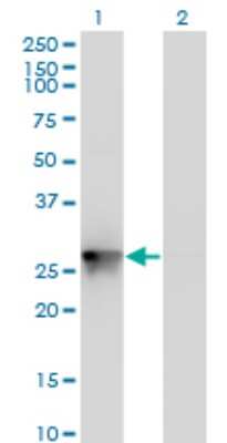 Western Blot: PYCRL Antibody (4F11) [H00065263-M01]